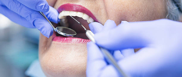 Best Emergency Dental Services for Seniors in Lake Fenton, MI